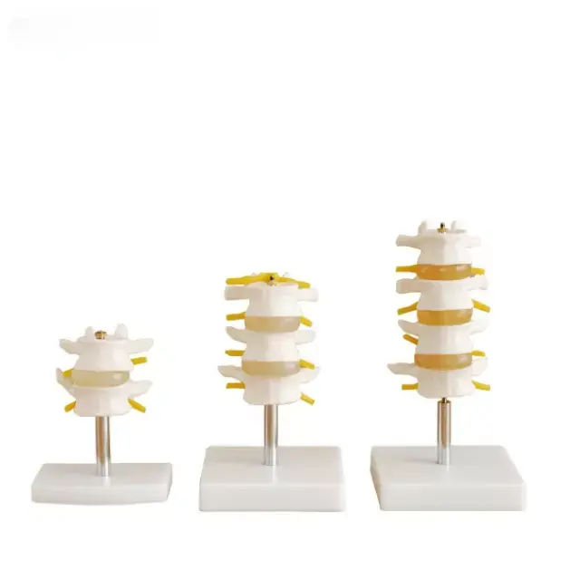 Conjunto de vertebras lumbares