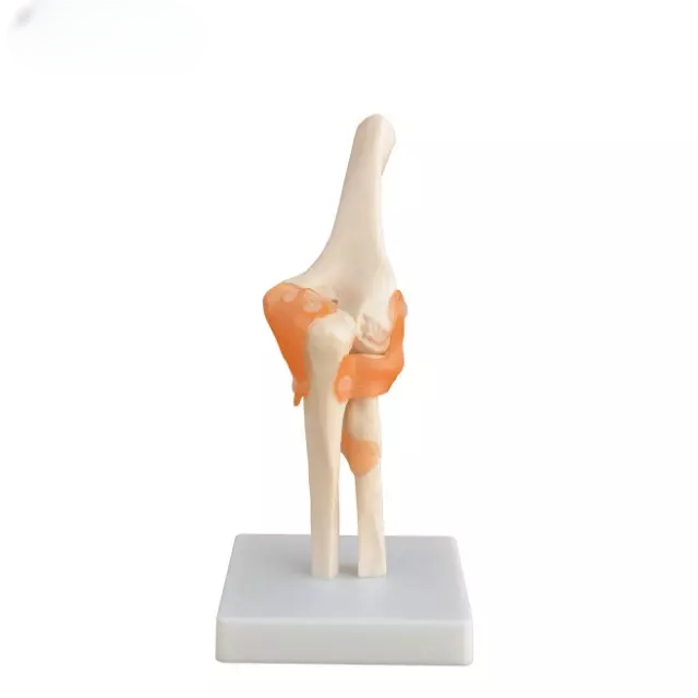 Articulacion del codo