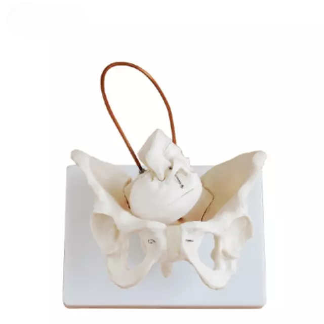 Demostracion de nacimiento