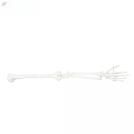 [b2-01-29-526] Extremidad superior (en parejas)